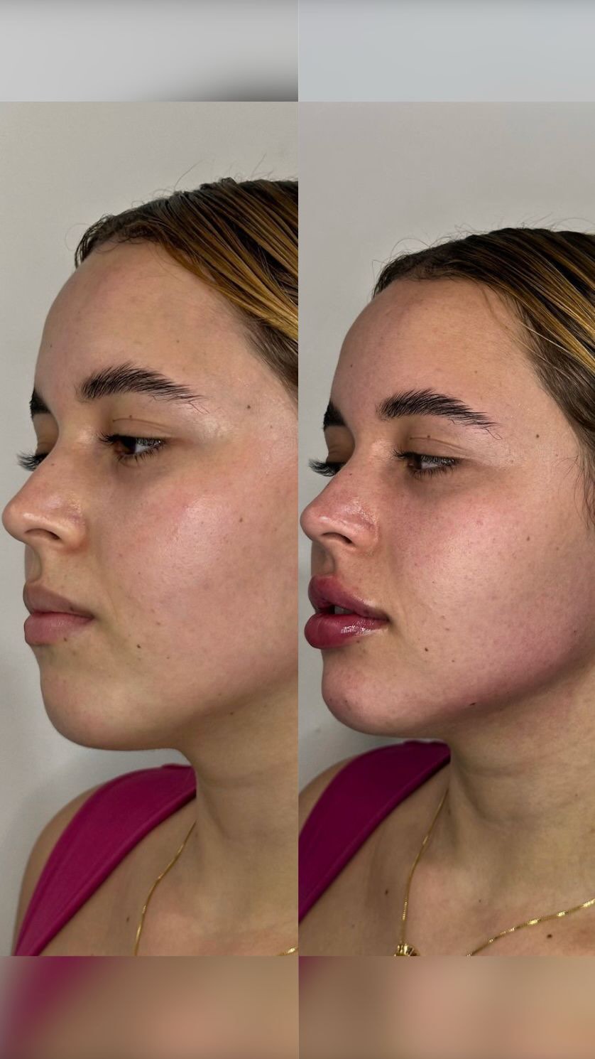 Antes e depois — caso 1